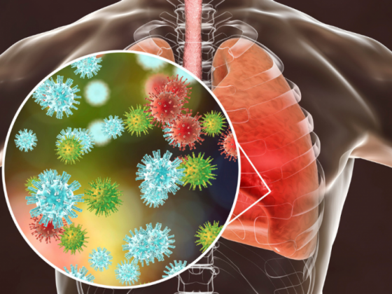 RSV increases health risks among senior citizens – expert